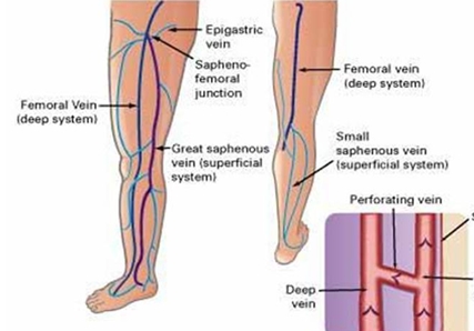 tinctura castana din vene varicoase funcionarea venelor varicoase pe picioarele picioarelor